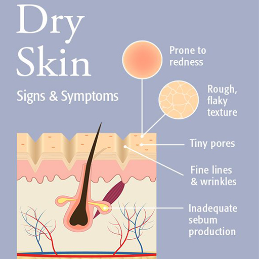 Signs and symptoms of dry skin