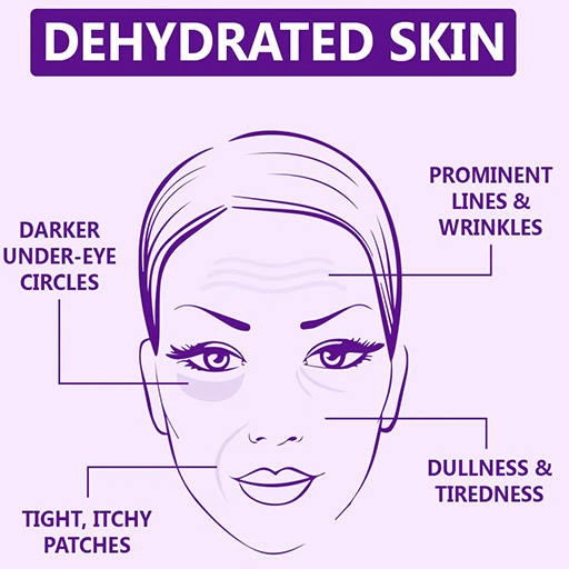 symptoms of dehydrated skin 