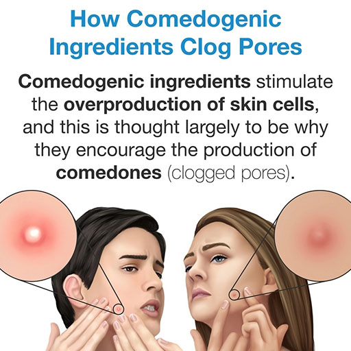 How non-comedogenic skincare products ingredients clog pores.