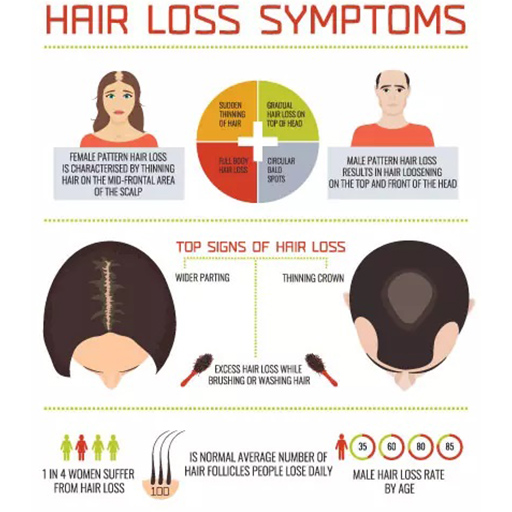 Symptoms of hair fall 