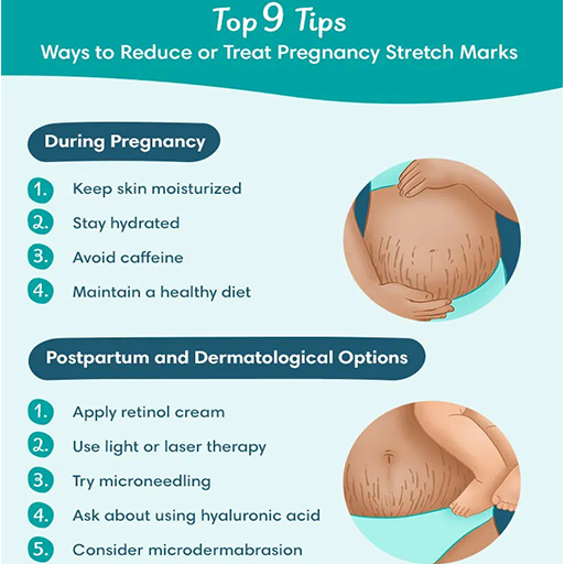 Ways to remove stretch marks after pregnancy