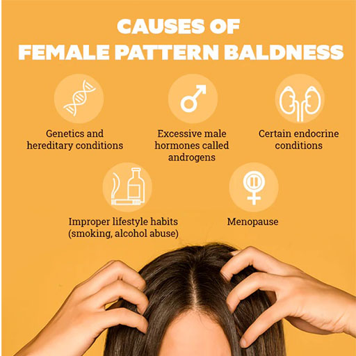 Causes of female pattern baldness